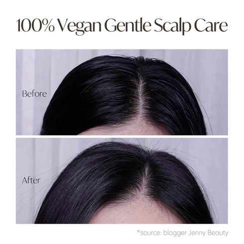 Professional Repairing Scalp Therapy Serum Shampoo 275ml-d'Alba-Matakana Pharmacy