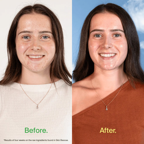 Skin Rescue Capsules 60s (replaces Estroclear)-BEPURE-Matakana Pharmacy