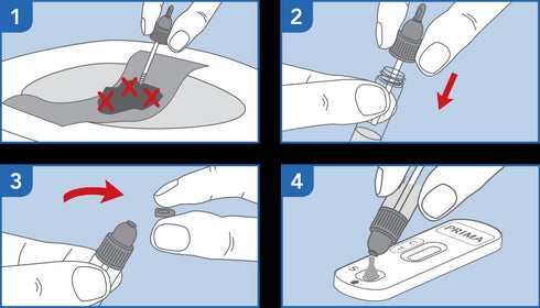 Image of PRIMA H. Pylori Antigen Test how to use