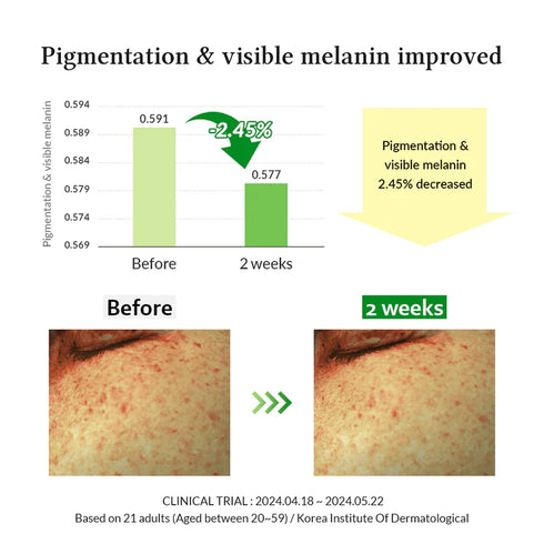 Gentle Vitamin C Serum 30mL-Dr.Althea-Matakana Pharmacy