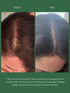 Before and after comparison of hair oil application on a person's scalp.