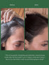 Before and after comparison of hair treatment on a person's head with text about product effectiveness.