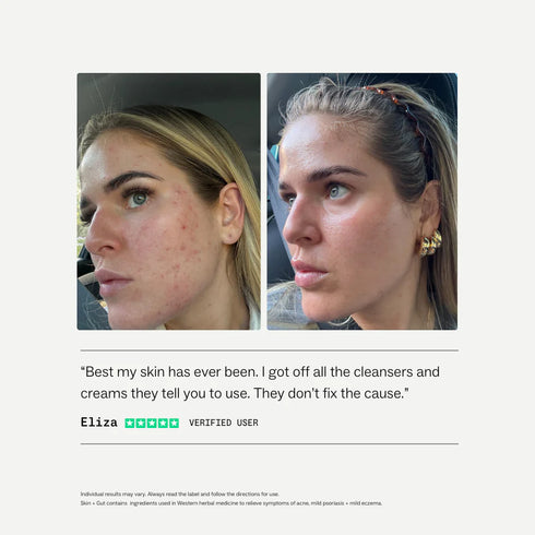 Skin + Gut 60 Capsules-my way up-Matakana Pharmacy