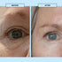 Image of Boost Lab eye reset serum before and after photos