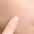 Spot Cover Patch 22 Pk-SKIN1004-Matakana Pharmacy