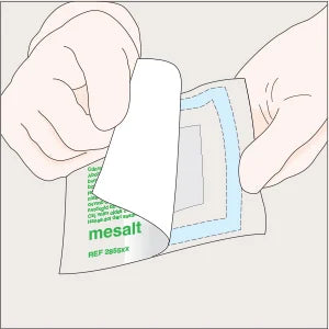 MOLNLYCKE MESALT CAVITY DRESSING 2CM X 100CM PACK 10-Matakana Pharmacy