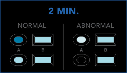 Image of PRIMA Sperm Home Test Kit results