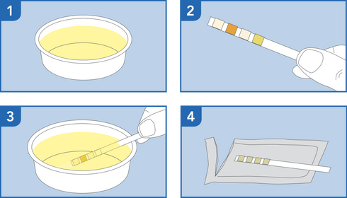 Image of PRIMA Urinary Tract Infections Home Test Kit how to use