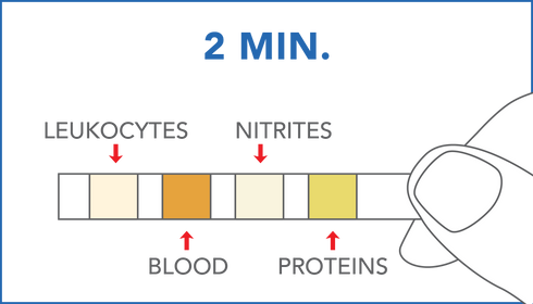 Image of PRIMA Urinary Tract Infections Home Test Kit results
