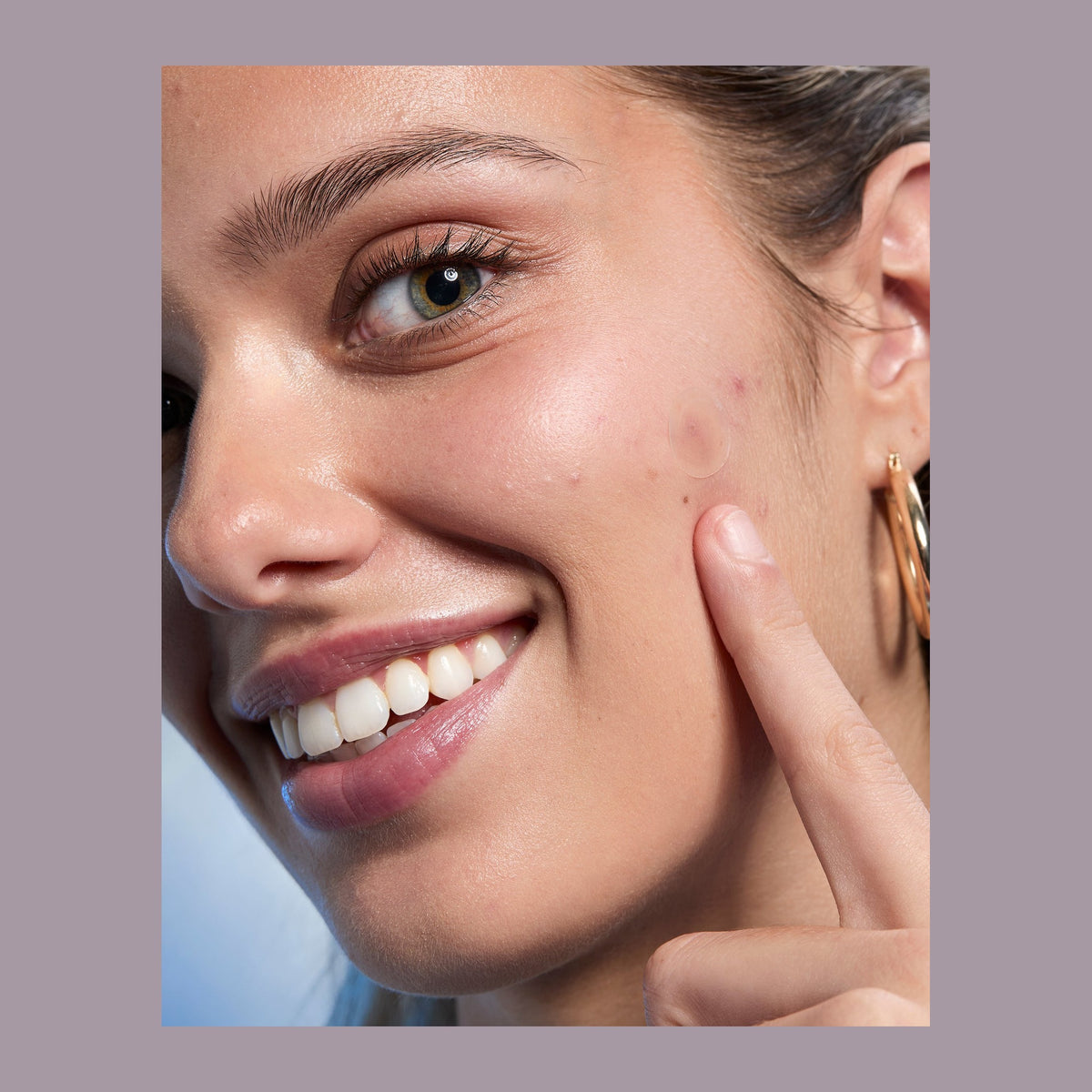 Natio Clear Pimple Patch Kit 27s shown in use