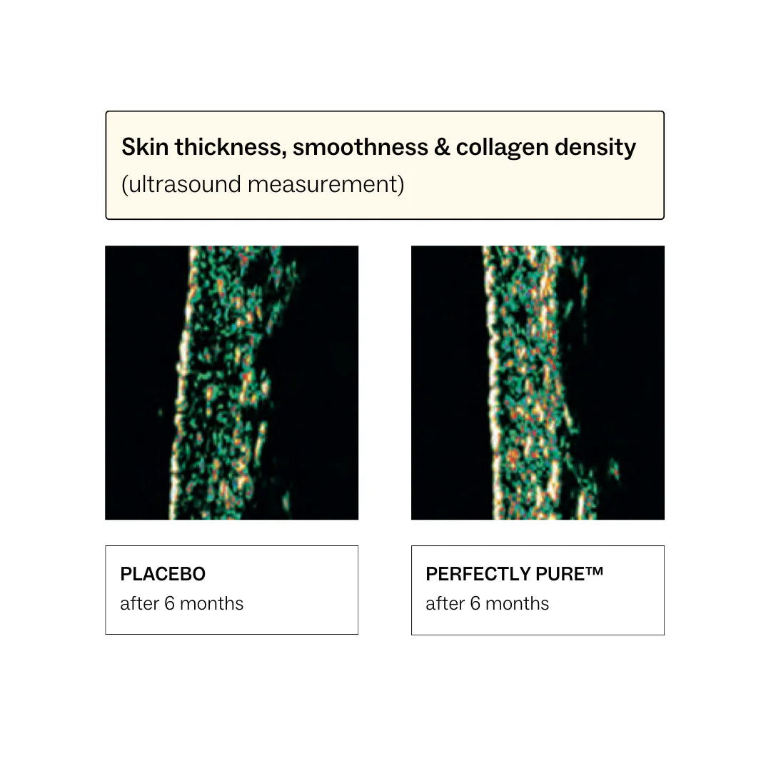 Collagen Peptides - Bovine 225g-my way up-Matakana Pharmacy