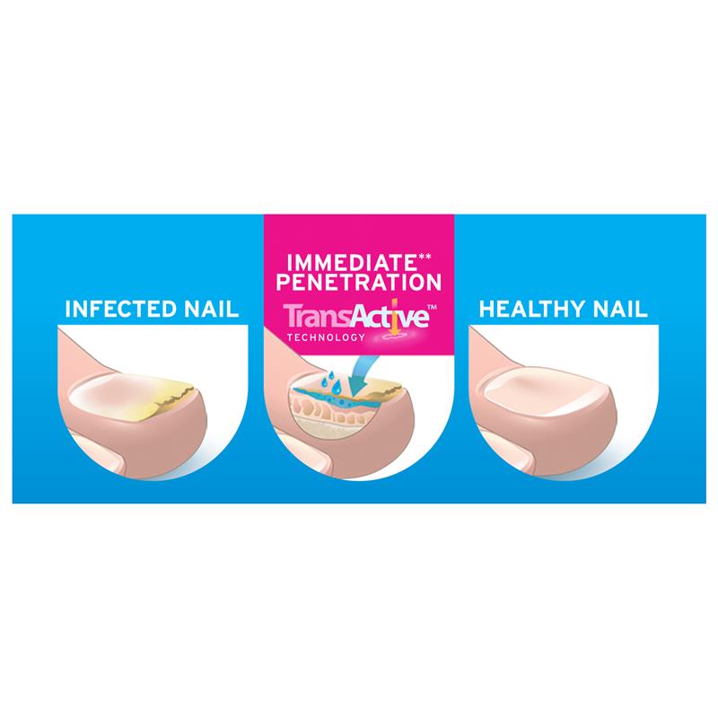 Excilor Nail Fungal Treatment Solution 3.3ml-Actor Pharmaceuticals-Matakana Pharmacy