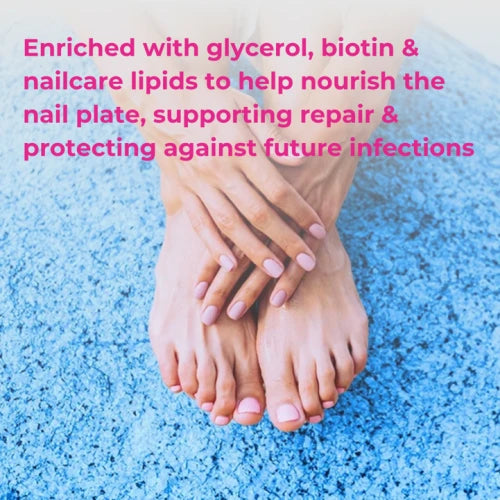 Excilor Nail Fungus Easy Pen-Actor Pharmaceuticals-Matakana Pharmacy