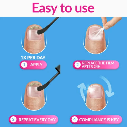Excilor Ultra Fungal Nail Treatment 30ml-Actor Pharmaceuticals-Matakana Pharmacy