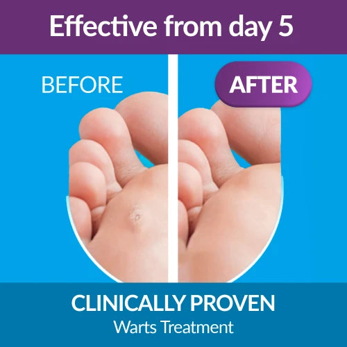 Excilor Wart Duo Power-Actor Pharmaceuticals-Matakana Pharmacy