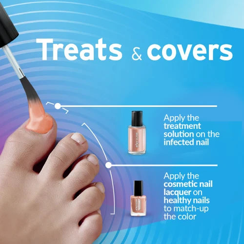 Excilor Nail Fungus Forte Ultra Colour Nude 30ml Bottle-Actor Pharmaceuticals-Matakana Pharmacy