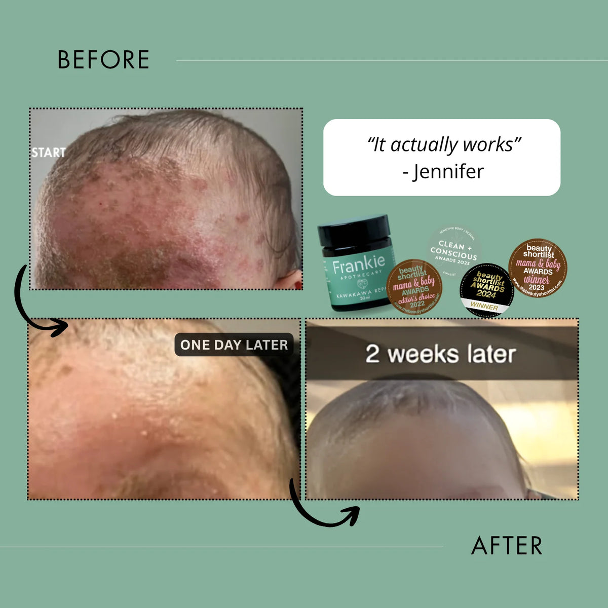 Kawakawa Repair Balm 105ml | Frankie Apothecary-Frankie Apothecary-Matakana Pharmacy