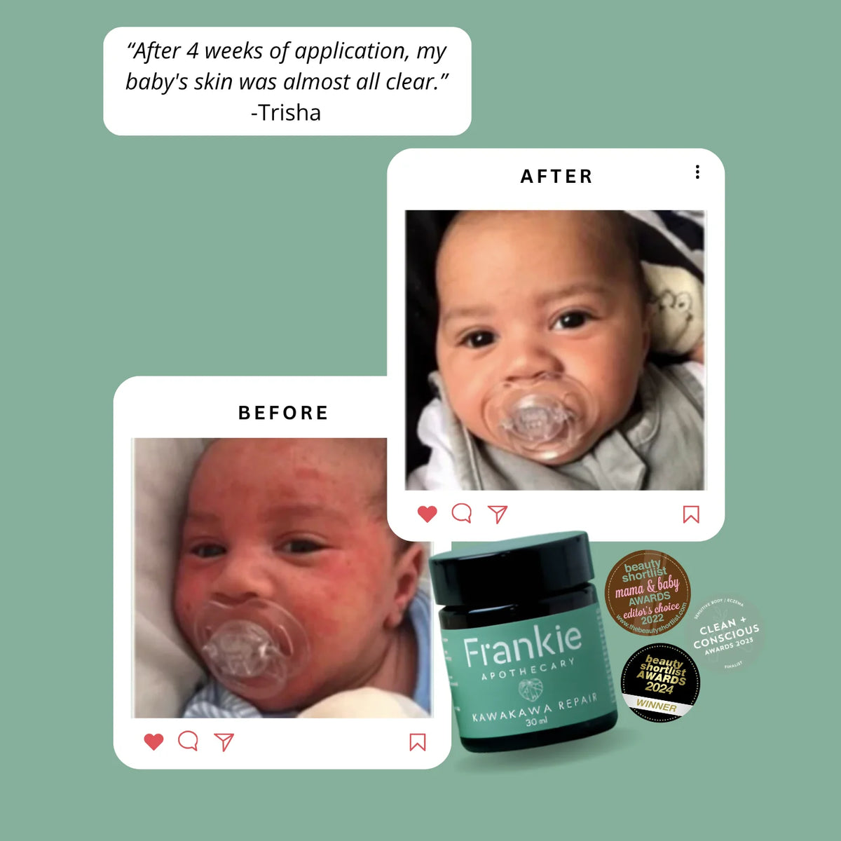 Kawakawa Repair Balm 105ml | Frankie Apothecary-Frankie Apothecary-Matakana Pharmacy
