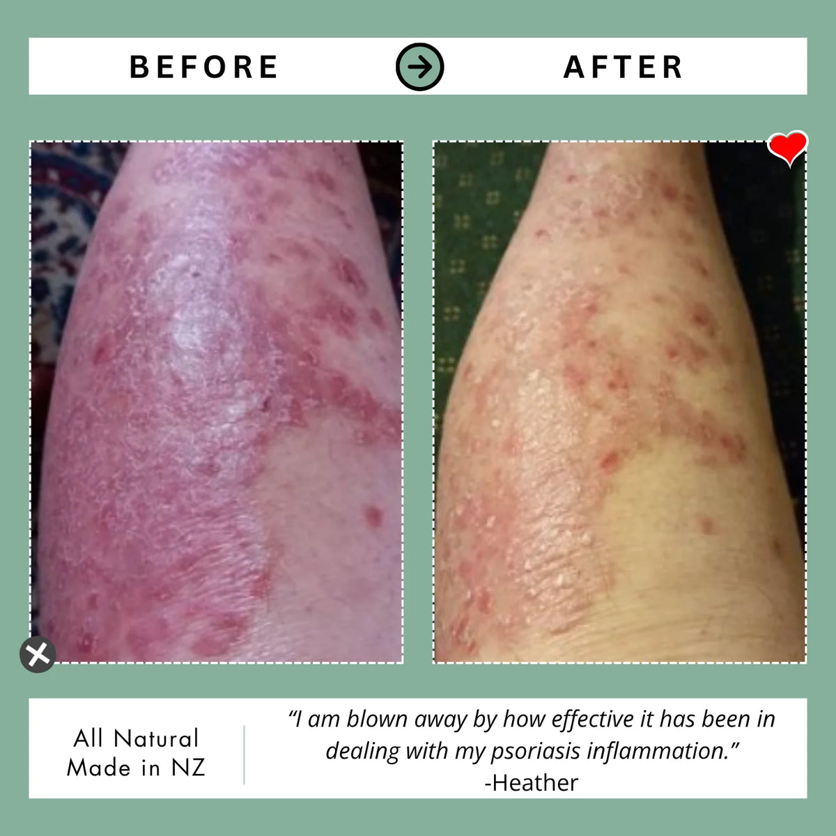 Kawakawa Repair Balm 105ml | Frankie Apothecary-Frankie Apothecary-Matakana Pharmacy