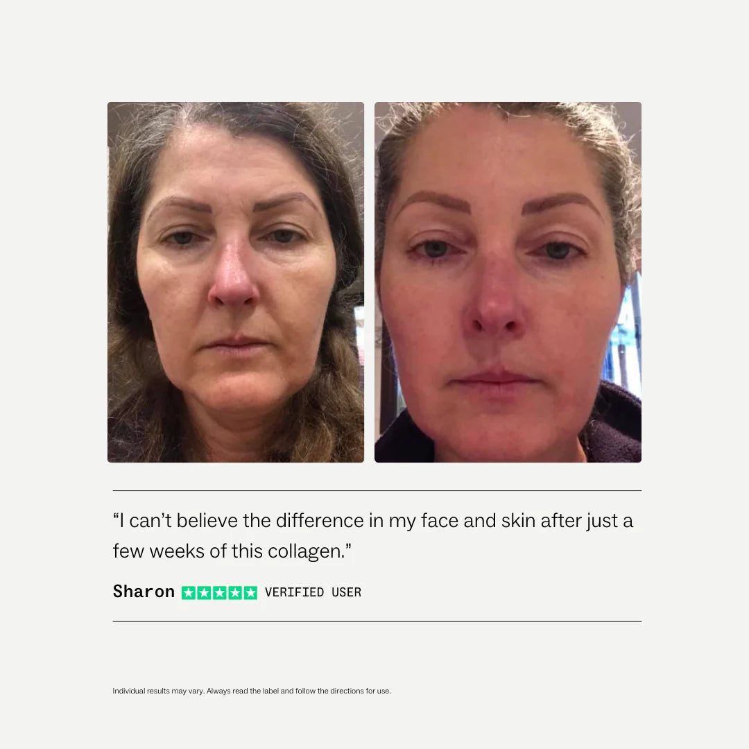 Collagen Restore 270g-my way up-Matakana Pharmacy