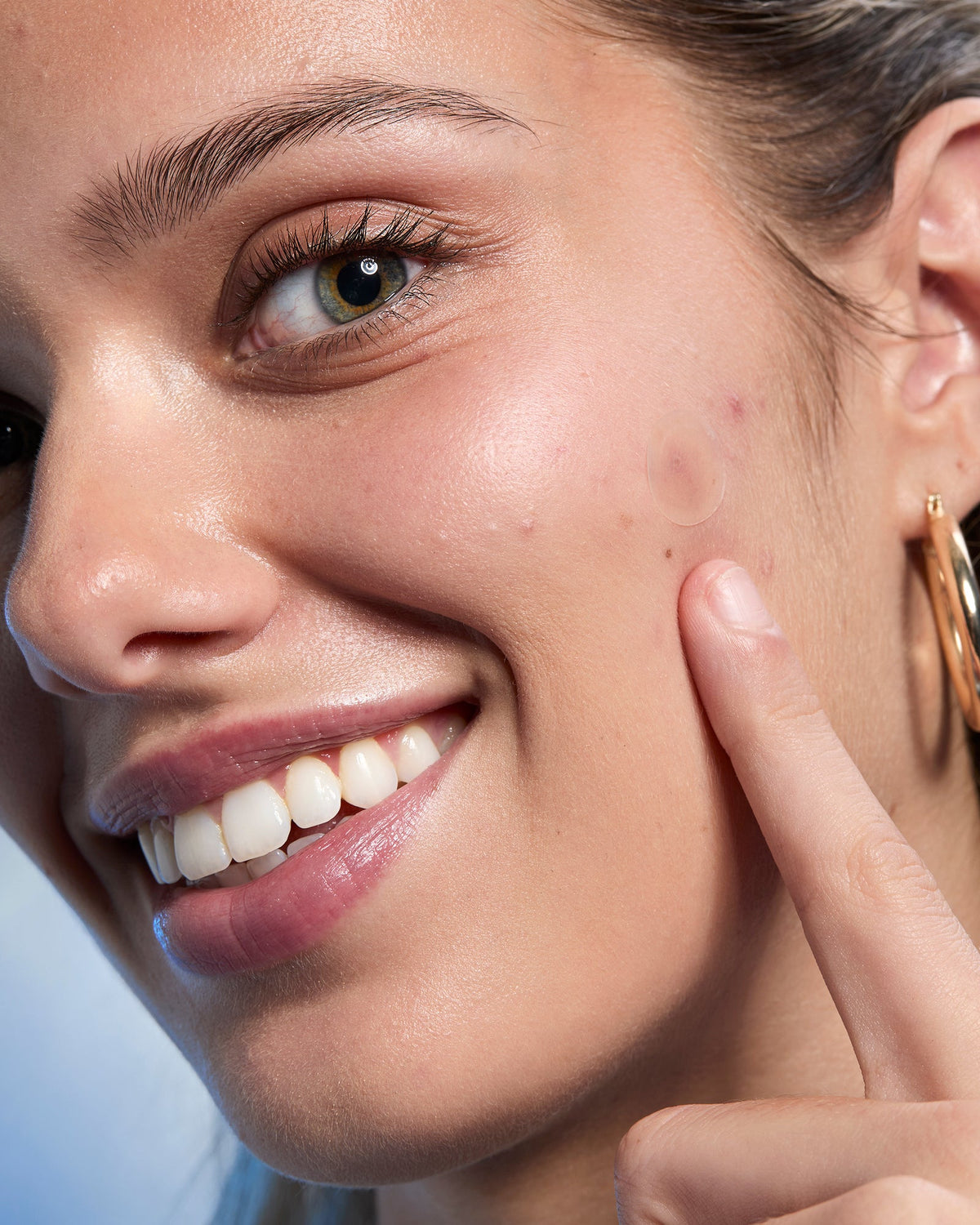 Clear Pimple Patch Kit 27s