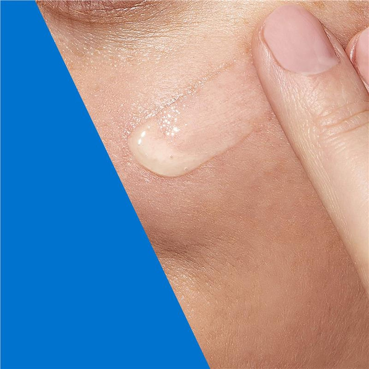 CeraVe Blemish Control Gel 40ml, in use