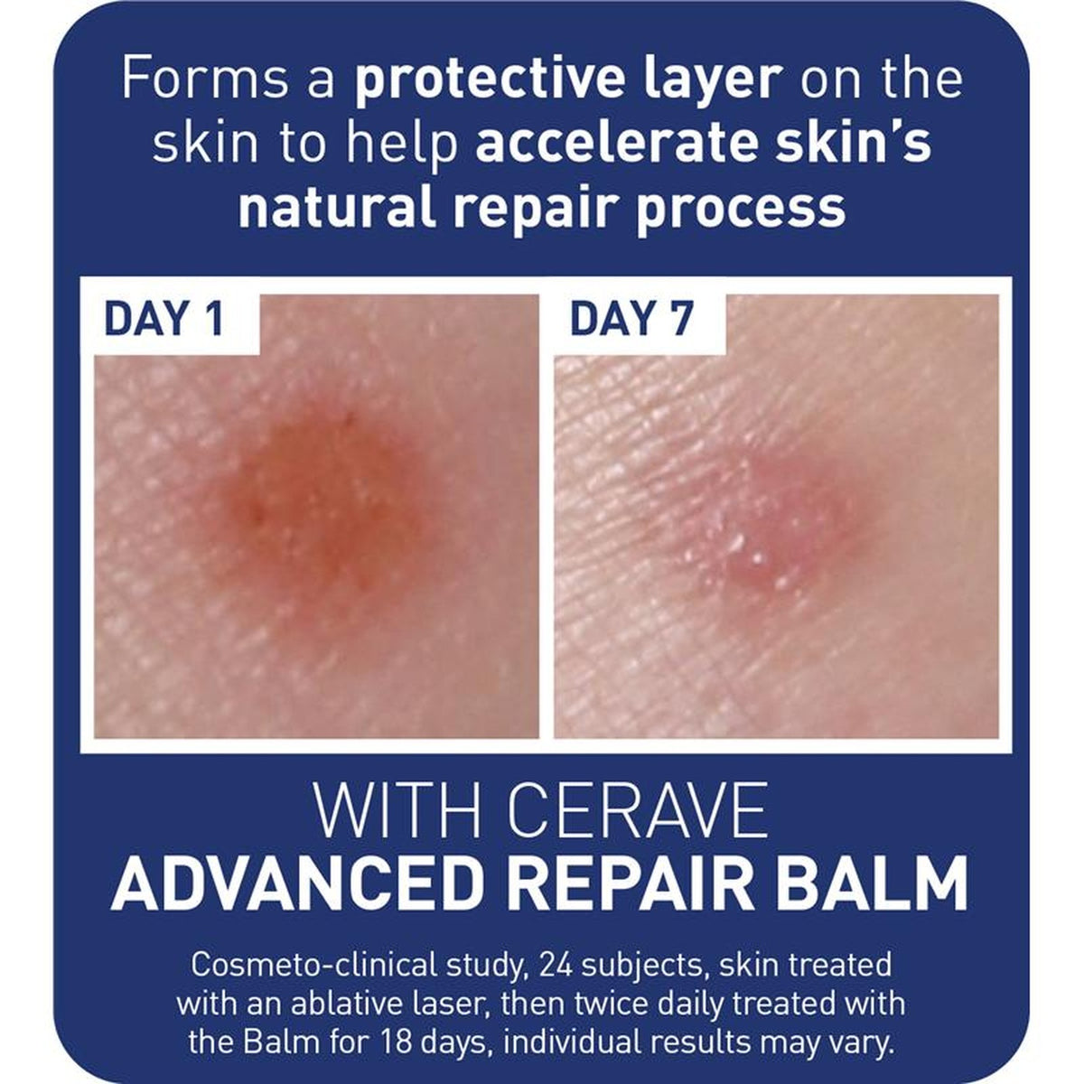 CeraVe Advanced Repair Balm 88ml, ingredients panel