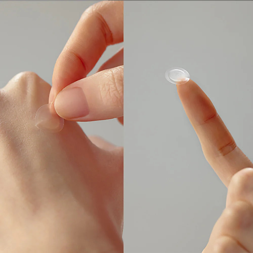 30 Days Miracle Clear Spot Patch-SOME BY MI-Matakana Pharmacy