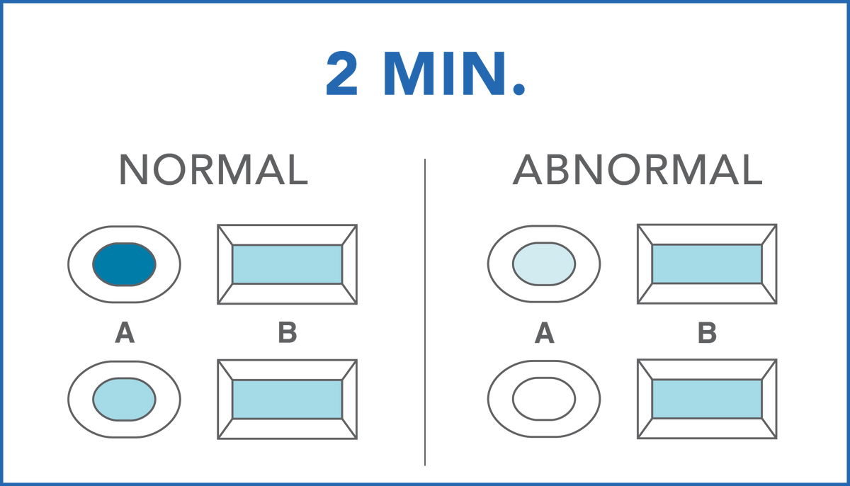 Image of PRIMA Sperm Home Test Kit results