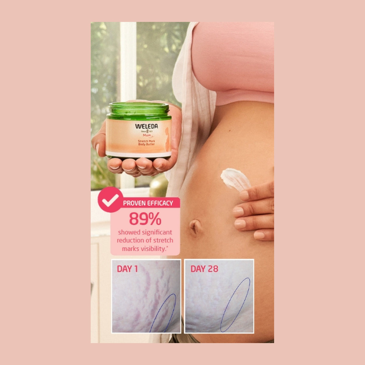 Weleda Stretch Mark Body Butter 150ml, pack detail